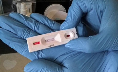 На Сумщині проводитимуть ІФА-тестування на антитіла до коронавірусу