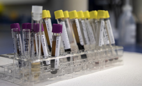 В Україні за добу на COVID-19 захворіли 833 людини: як змінилася ситуація на Луганщині