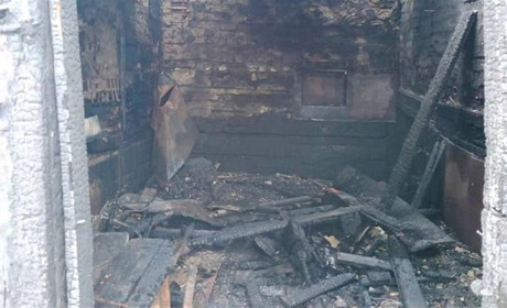 Пожежа в Чернігівській області: чоловік отримав опіки III ступеня