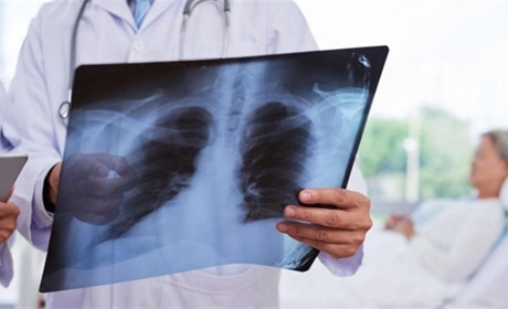 Що відбувається з легенями хворих на коронавірус