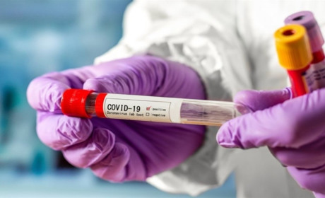 Новий летальний випадок по області. А яка ситуація в Мелітополі?