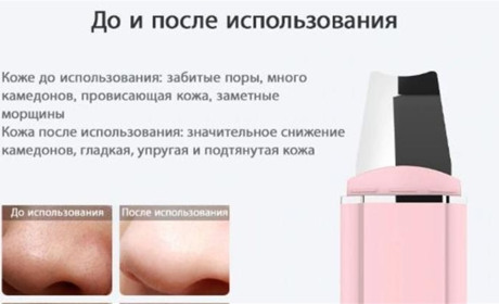 Ультразвуковой скрабер для лица