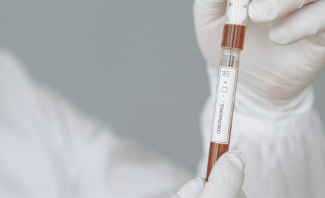 За дві доби у Сватівському районі COVID-19 підтвердили у 18 людей: що про це відомо