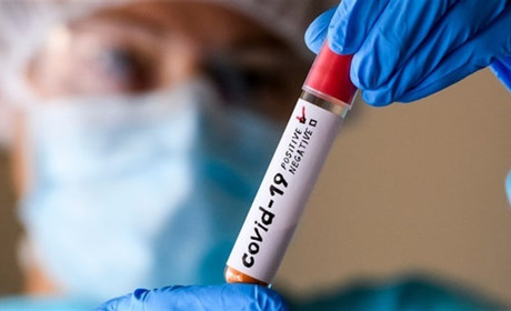 В Україні за добу + 15125 хворих на COVID-19: яка ситуація у Сватівському районі і на Луганщині