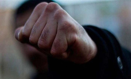 Повідомили про підозру черкащанину, який жорстоко побив чоловіка