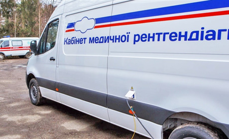 Виїзди мобільної рентген-лабораторії по області планують відновити, – облдержадміністрація