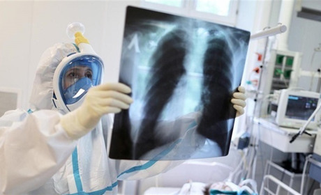 У Фастівській громаді захворюваність на COVID-19 за тиждень зросла у 3,2 рази