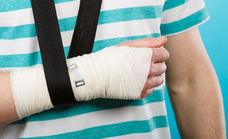 Як відрізнити перелом від інших ушкоджень та що робити: консультують медики Білопільської первинки