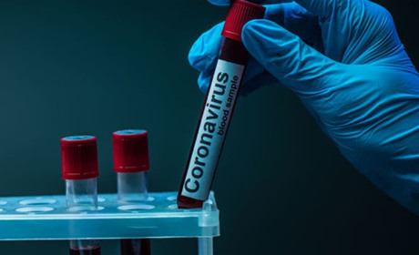 Показники захворюваності Золотоніщини на Covid-19 знову стабілізувалися