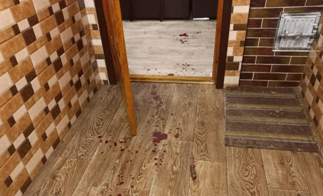 У селі Сарненського району чоловік вбив 20-річну вагітну дружину