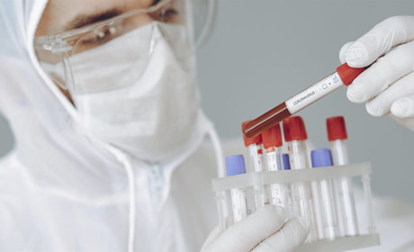 У Луганській області за добу плюс 13 хворих на COVID-19. Яка ситуація у Сватівському районі