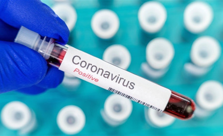 Ситуація з COVID-19 на 1 листопада: у Вараському районі – 12 нових хворих