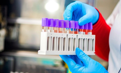 Статистика дня по коронавирусу: в Запорожской области снова есть заболевшие 