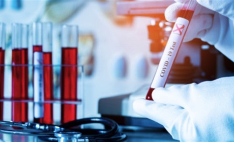 У Сватівському районі +70 хворих на COVID-19: яка ситуація з поширенням хвороби у Луганській області