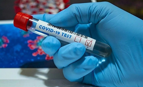 Стало відомо, скільки в Южному захворіло людей за останню добу на коронавірус (ІНФОГРАФІКА)