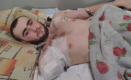 Втратив руку під час бойового завдання: як підтримати збір для бійця із Сарн Сергія Шаламая