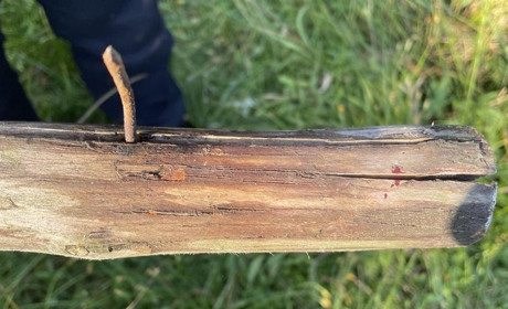 Житель Сарненщини потрапив у лікарню через сусідські розбірки