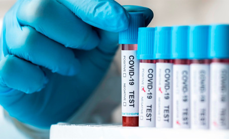 COVID-19 в Україні: яка ситуація з поширенням на Сватівщині і у Луганській області на ранок 1 грудня