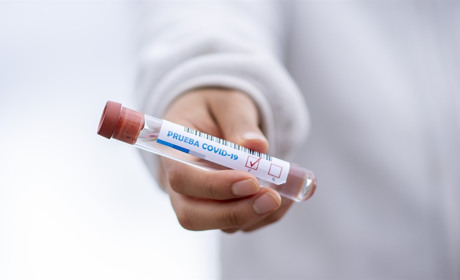 COVID-19 на Сватівщині і Луганщині: актуальна статистика поширення станом на 29 березня