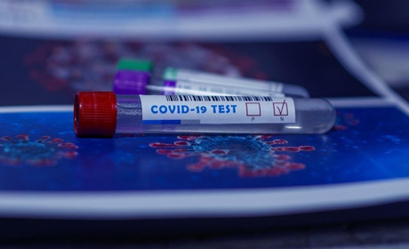 Кількість хворих на Covid у місті зростає: Нетішин уже перетнув позначку 200