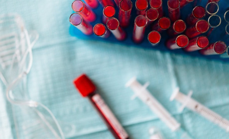 Ситуація з коронавірусом на 30 вересня: на Володимиреччині 347 випадків захворювань, у Вараші – 450