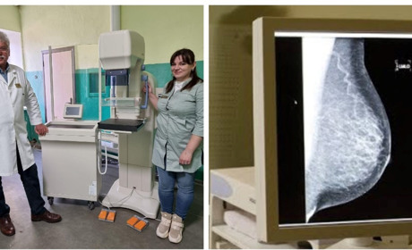 Жінки зможуть проходити безкоштовно обстеження молочних залоз: за кошти бюджету придбали мамограф