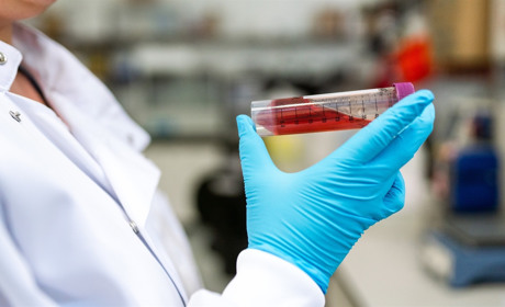 Кількість хворих на COVID-19 в Україні на добу зросла на 143. Наразі зафіксовано 1462 випадки