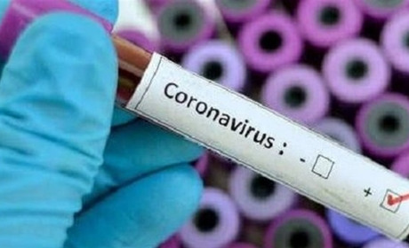 101 випадок ковіду в області за добу