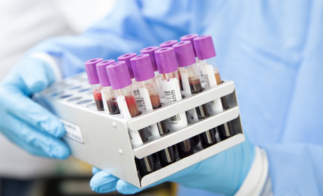 У Луганській області за добу COVID-19 підтвердили ще у однієї людини. В Україні плюс 841 за добу