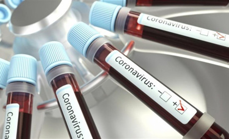 Статистика по коронавірусу на 7 вересня: у Вараші – 357 хворих, на Володимиреччині – 257