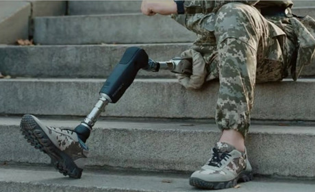 Захисники зможуть отримувати високофункціональні протези швидше: Кабмін ухвалив рішення