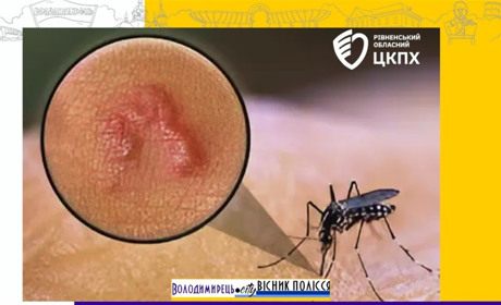 В чоловіка з Зарічного виявили великого підшкірного паразита