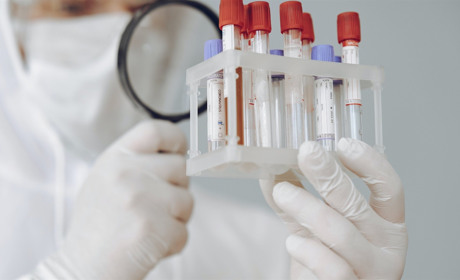 За минулу добу в Україні COVID-19 підтвердили у 14575 людей: яка ситуація у Сватівському районі