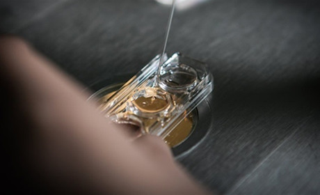 Сколько стоит процедура ЭКО в Киеве в клинике IGR?