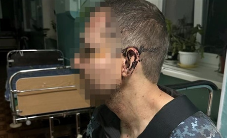 У військовій частині на Одещині побили військового: почали розслідування