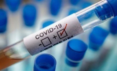 COVID-19: перетнули позначку 180. Невже місто рухається до "червоної" зони