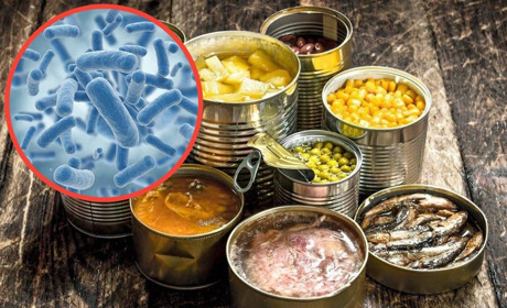 У Вараському районі від ботулізму помер чоловік