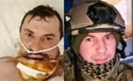 В Барі 5 лютого буде благодійний концерт на підтримку пораненого воїна Сергія Костюченка