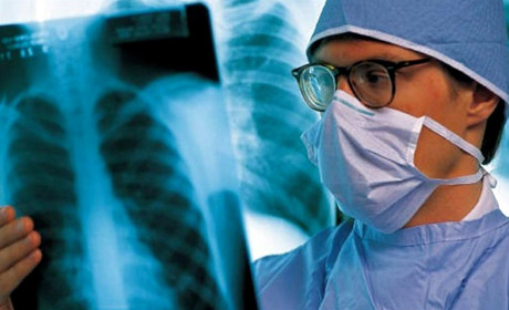 Туберкульоз: ранній початок лікування – запорука успішного одужання