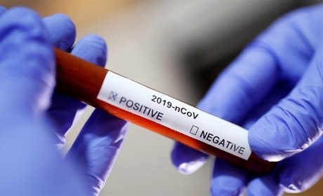 В Україні є рекорди, пов’язані з коронавірусом, а в Запорізькій області – нова смерть від COVID-19