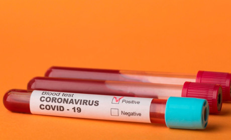 На порозі «червоної» зони: скільки хворих на COVID-19 на Сватівщині і Луганщині на 27 жовтня