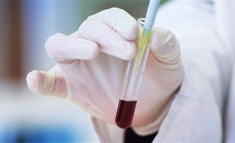 На Луганщині ще у п’ятьох людей підтвердили захворювання на COVID-19