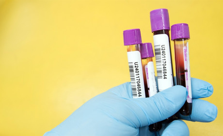 У Луганській області проводять епідеміологічне розслідування по 131 підозрі на COVID-19