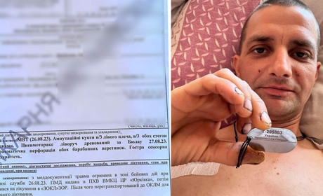Городоччани збирають кошти на протезування земляку. Роман Цимбалюк втратив обидві ноги та руку