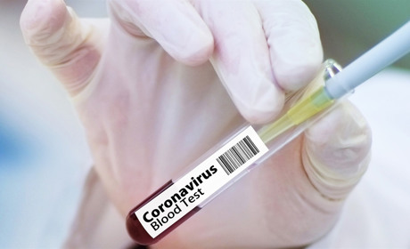 За останню добу в Україні підтвердили 62 випадки захворювання на COVID-19. Яка ситуація у Сватовому