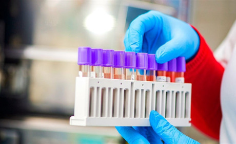 Дані на 17 липня: у Вараші 175 хворих, на Володимиреччині – 131. Загалом 224 вилікувалося