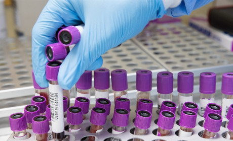 В Україні ще 528 людей захворіли на COVID-19 за минулу добу: яка ситуація у Сватівському районі