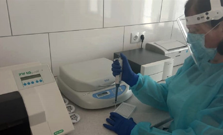 Дізнатися, чи є у вас імунітет до коронавірусу, вже можливо і в Мелітополі