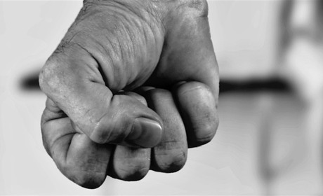 Після побиття мешканка Барської громади Леся Токова потребує допомоги