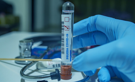 Кількість випадків захворювання на COVID-19 в Україні перевищила 14 тисяч. Що у області і районі